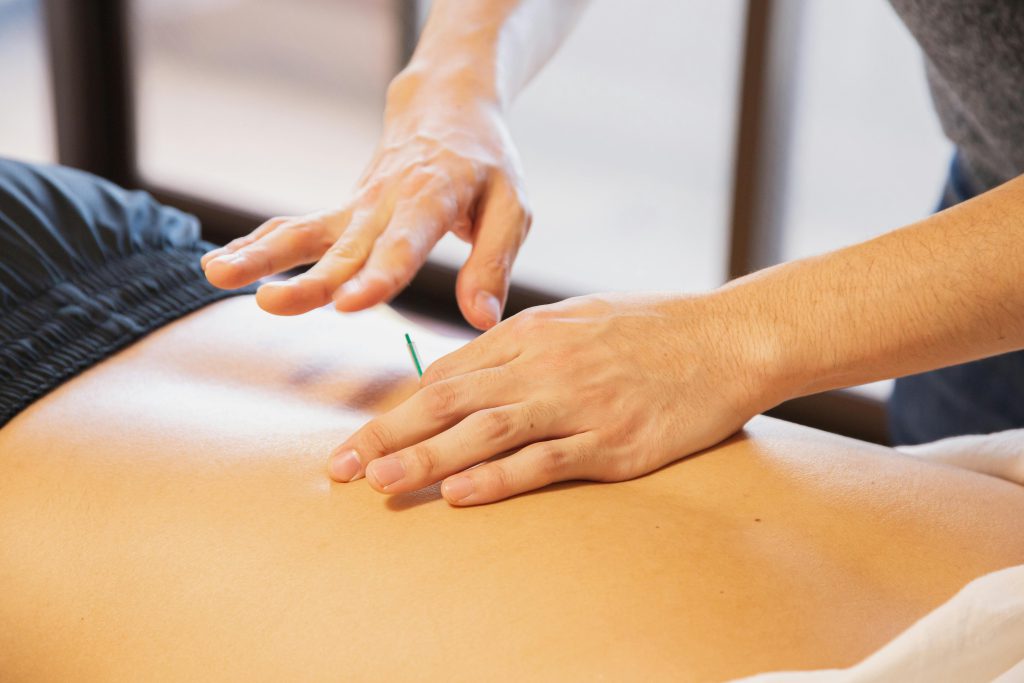 Fisioterapeuta aplicando punción seca en espalda de paciente joven